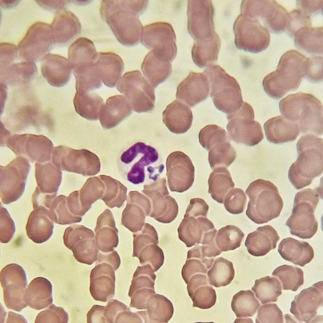 Diagnostyka leukopenii u kotów