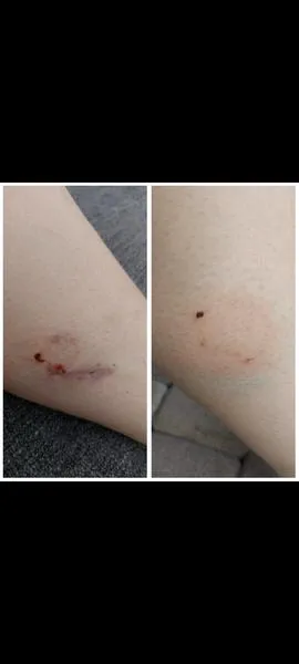 Przyczyny agresji u psów